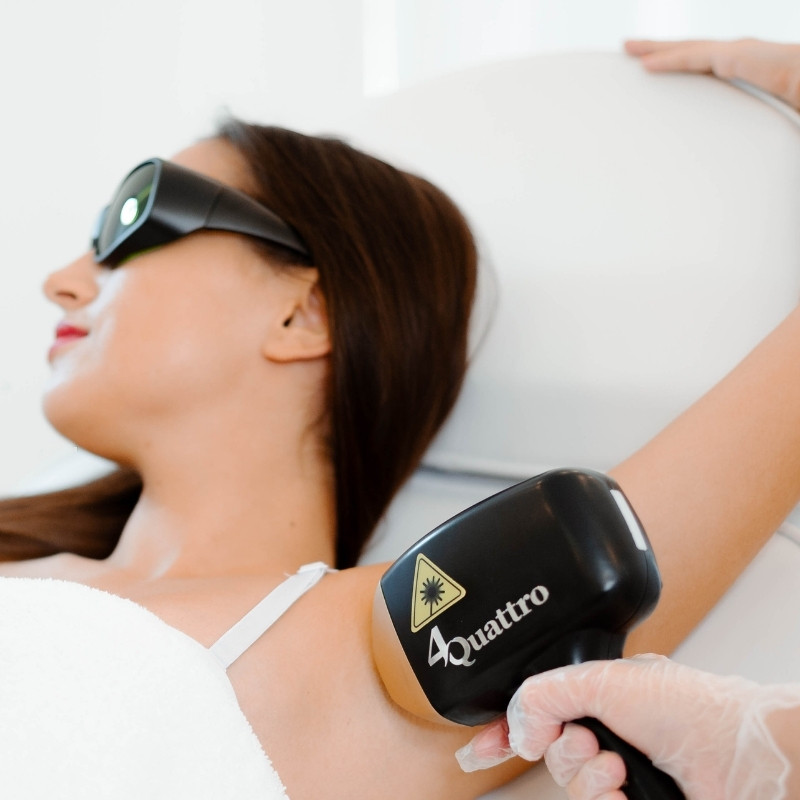 Ședință de epilare definitivă cu laser: clienta poartă ochelari de protecție, specialista lucrează pe zona axilei.